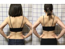 アリス フィットネスサロン/＊ブライダル施術効果＊