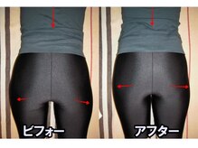 門田カイロクリニックの雰囲気（ダイエット応援を２,３月各コースそれぞれ３名まで募集。痩身へ）