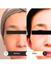 ゆう/ビフォーアフター