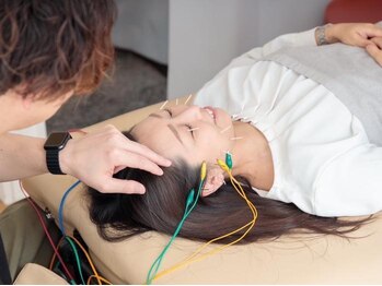 小顔矯正整体サロン イクサス(IxAS)の写真/【美容鍼×小顔矯正×姿勢矯正】のリフトアップメソッドでシャープな理想の輪郭を速攻実感◎
