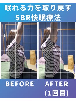 ぐっすりん/SBR快眠療法ビフォーアフター