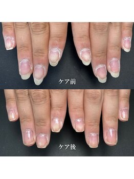 ココ(COCO)/ハンドケア・自爪育成・深爪育成