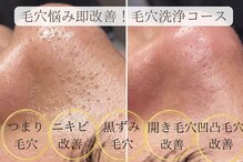 エミマス ボーテ(Emimas Beaute’)