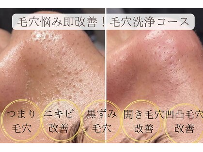 エミマス ボーテ(Emimas Beaute’)の写真