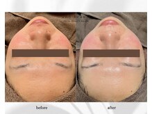 アン ビューティー(ann beauty)/リピーター様