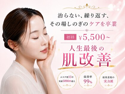 シャルナ(charna)の写真