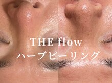 ザ フロウ(THE flow)/ハーブピーリング1回｜B→A