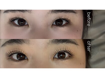 エトワール(Etoile)の写真