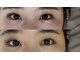 エトワール(Etoile)の写真