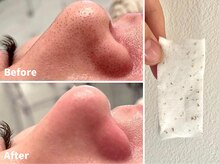 ファシー 四日市(fachi.)/ホットミスト・手技で徹底改善