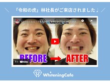 ホワイトニングカフェ 本厚木店/ホワイトニングカフェ本厚木店