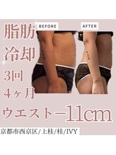 アイビー(IVY)/ウエストー11cm