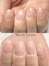 マリーロール 淀屋橋本店(Marie Laure)/自爪育成/深爪矯正/ネイルケア