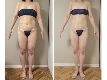 ラフォクシー(La.Foxy)/初回カウンセリング時の目標に