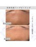 【極上の癒し＆お肌の透明感UP↑】もみほぐし×ハーブピーリング ¥16500→