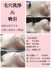 ビヨウイリョウテイケイ プリード(美容医療提携 PULIDO）)/毛穴洗浄もやってます