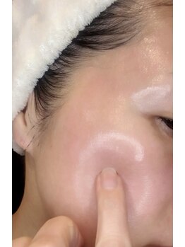 ミヨン(Miyong)/つやっつやのお肌に