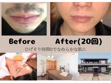 ルポ(Repos)