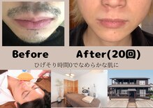 ルポ(Repos)