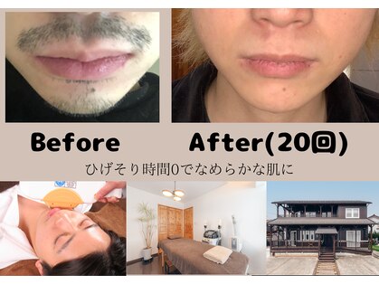 ルポ(Repos)の写真