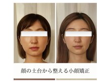 ミラクル(Miracle)の雰囲気（オリジナルの技術でお顔の土台となる骨格から整えます）