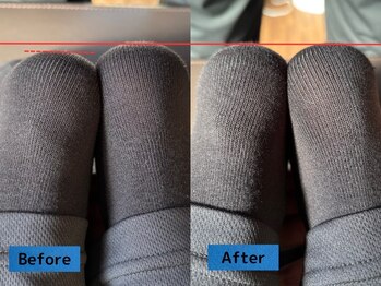 鈴家/猫背矯正/ビフォー/アフター