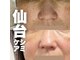 アンソロジー(Anthology)の写真