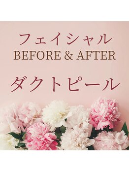 ゼロ 水戸店(ZERO)/ダクトピール★before&after