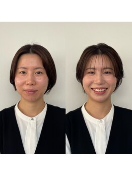 パーソナルサンフラワー(PersonalSunflower)/お客様ヘアメイク Before/After