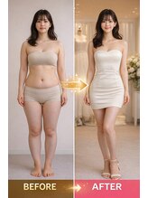 アプロ(Aphro)/別人級スタイル