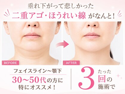 クアダ 天神(QUADA)の写真