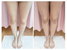 美容整体カラダリメイク(karada)/骨盤矯正ダイエットの結果