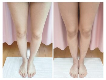 美容整体カラダリメイク(karada)/骨盤矯正ダイエットの結果