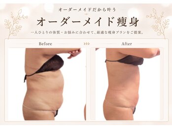 ナナイロ(nanairo)の写真/【結果重視・大分唯一無二】何をしても痩せなかった方へ！理想のBODYを叶える本格オーダーメイド痩身。
