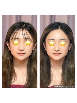 クラルスシンメトリーサロン 高槻店(Clarus Symmetry Salon)/小顔特化コース♪
