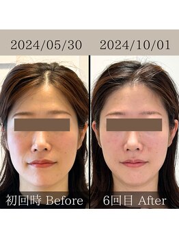 エテルニテ(eternite)/劇的変化！！