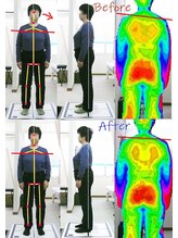 姫路なごみ整体院 なごみ鍼灸院/【改善例】肩こり・頭痛・シビレ
