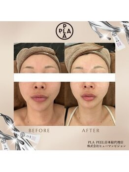 ココ センガ ビューティー クリニック(COCO SENGA Beauty-Clinic)/韓国認定講師サロン（日本公式）