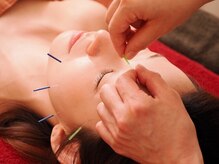 ノエルアシヤ(Noel ASHIYA)