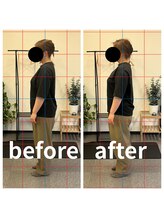 熊本カワル整体 JR上熊本駅院/ストレートネック・巻き肩