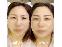 美ラボ リッチエンジェル/韓国アーチ眉