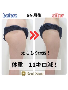 レアルステイト 金沢店/太ももセルライトもすっきり!