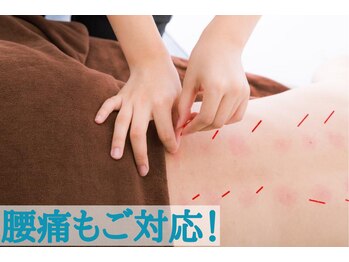 泉町鍼灸整骨院/腰痛もお任せください！