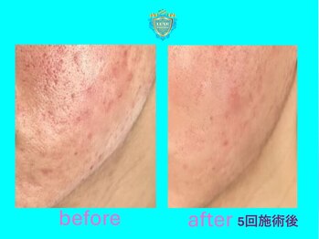 リュクス(LUXE)/ビフォーアフター