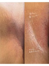 オニュ(onyu)/2ヶ月での変化［北九州/永犬丸］