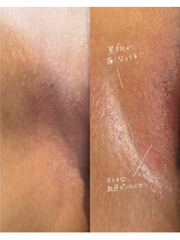 オニュ(onyu)/2ヶ月での変化［北九州/永犬丸］