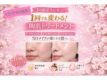 ムーンサン(Moon sun)