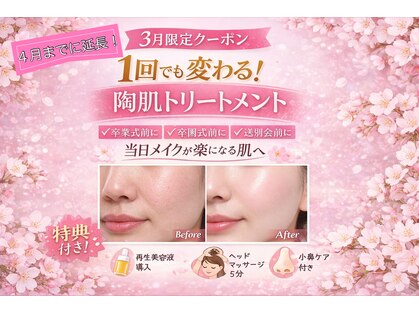 ムーンサン(Moon sun)の写真