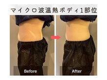インナーグロウ 中目黒(INNER GLOW)の雰囲気（マイクロ波温熱ボディ(腹部)/1度でも変化を実感◎）