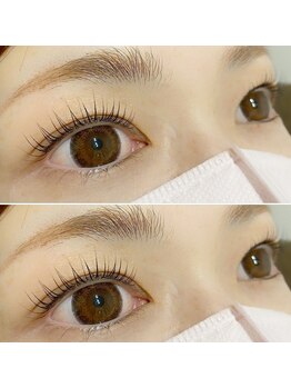 アン(an)の写真/綺麗な仕上がりと圧倒的モチ力！可愛い～大人女性まで支持率◎丁寧なカウンセリングと高技術で垢抜け顔に♪